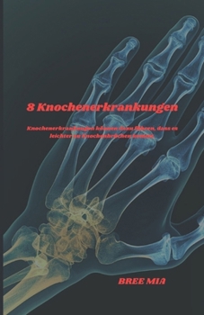 8 Knochenerkrankungen: Knochenerkrankungen können dazu führen, dass es leichter zu Knochenbrüchen kommt. (German Edition)