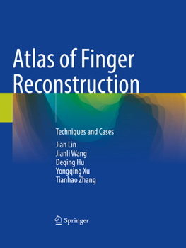 Paperback Atlas of Finger Reconstruction: Techniques and Cases Book