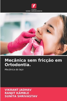 Mecânica sem fricção em Ortodontia.: Mecânica do laço