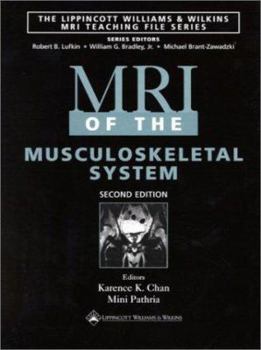 Hardcover MRI of the Musculoskeletal System Book