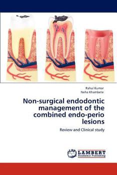 Paperback Non-surgical endodontic management of the combined endo-perio lesions Book