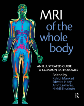 Paperback MRI of the Whole Body : An Illustrated Guide to Common Pathologies Book