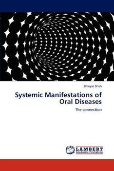 Paperback Systemic Manifestations of Oral Diseases Book