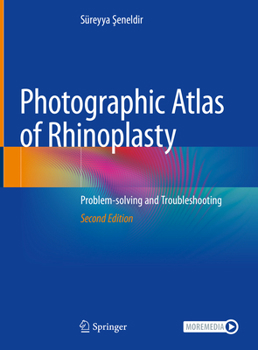 Hardcover Photographic Atlas of Rhinoplasty: Problem-Solving and Troubleshooting Book