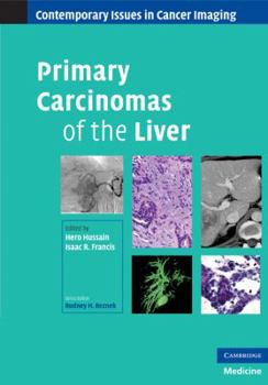 Hardcover Primary Carcinomas of the Liver Book