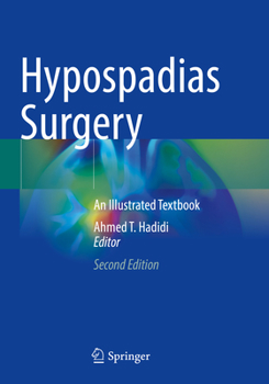 Paperback Hypospadias Surgery: An Illustrated Textbook Book