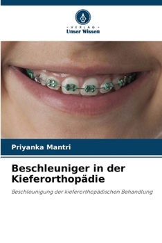 Beschleuniger in der Kieferorthopädie (German Edition)