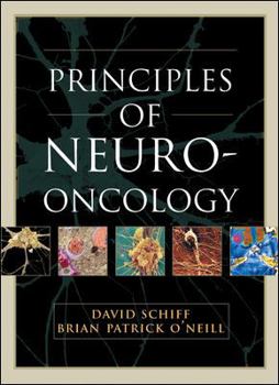 Hardcover Principles of Neuro-Oncology Book