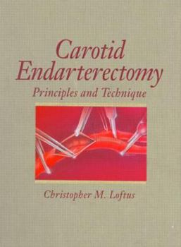 Hardcover Carotid Endarterectomy: Principles and Technique Book