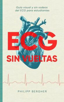 Paperback ECG SIN VUELTAS: Guía visual y sin rodeos del ECG para estudiantes (Spanish Edition) [Spanish] Book