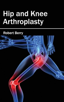 Hardcover Hip and Knee Arthroplasty Book