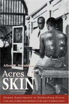 Paperback Acres of Skin: Human Experiments at Holmesburg Prison Book