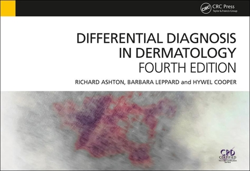 Paperback Differential Diagnosis in Dermatology Book