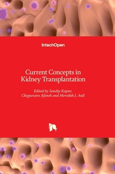 Hardcover Current Concepts in Kidney Transplantation Book