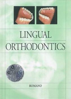 Paperback Lingual Orthodontics [With CDROM] Book