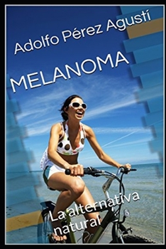 Paperback Melanoma: La alternativa natural [Spanish] Book