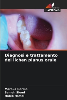Paperback Diagnosi e trattamento del lichen planus orale [Italian] Book