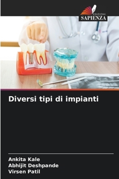 Diversi tipi di impianti (Italian Edition)