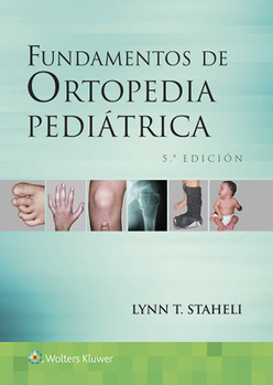 Paperback Fundamentos de Ortopedia Pediátrica [Spanish] Book