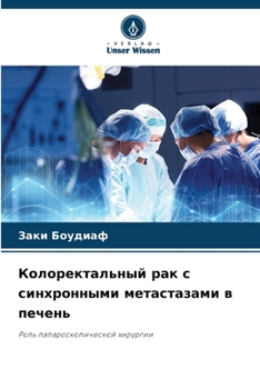 Paperback Колоректальный рак с син [Russian] Book