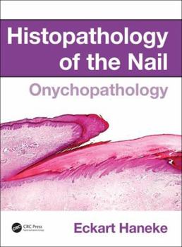 Hardcover Histopathology of the Nail: Onychopathology Book