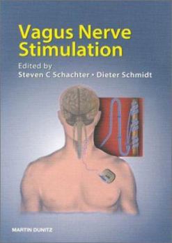 Paperback Vagus Nerve Stimulation Book