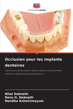 Occlusion pour les implants dentaires (French Edition)