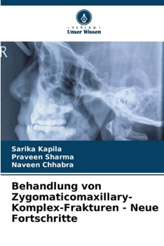 Paperback Behandlung von Zygomaticomaxillary-Komplex-Frakturen - Neue Fortschritte [German] Book