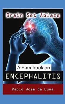 Paperback Brain Set Ablaze: A Handbook on Encephalitis Book