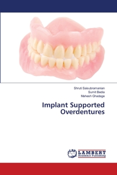 Paperback Implant Supported Overdentures Book