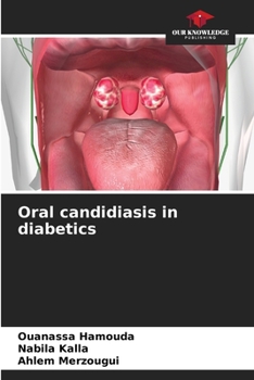 Paperback Oral candidiasis in diabetics Book