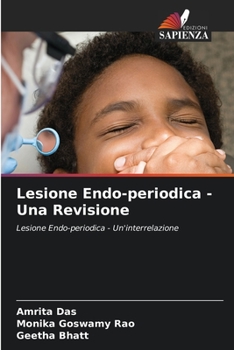 Paperback Lesione Endo-periodica - Una Revisione [Italian] Book