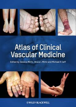 Hardcover Atlas of Clinical Vascular Medicine Book