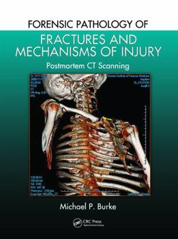 Paperback Forensic Pathology of Fractures and Mechanisms of Injury: Postmortem CT Scanning Book