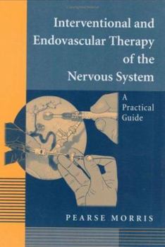 Hardcover Interventional and Endovascular Therapy of the Nervous System: A Practical Guide Book