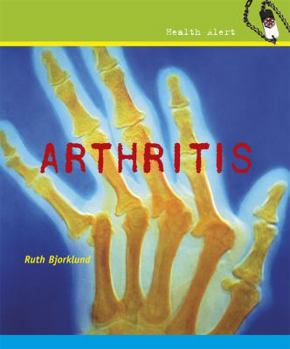 Library Binding Arthritis Book