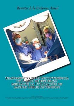 Paperback Tratamiento de la Incontinencia Urinaria de Esfuerzo mediante la utilización de Bandas Libres de Tensión: Revisión de la evidencia actual [Spanish] Book