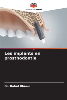 Paperback Les implants en prosthodontie [French] Book