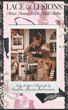 Paperback Lace & Lesions: Blood, Beauty & The Battle Within Book