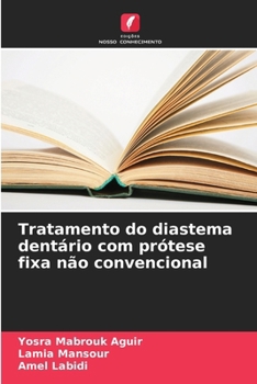 Tratamento do diastema dentário com prótese fixa não convencional (Portuguese Edition)