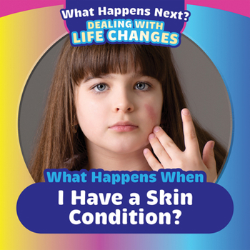 Library Binding What Happens When I Have a Skin Condition? Book