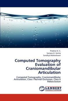 Paperback Computed Tomography Evaluation of Craniomandibular Articulation Book
