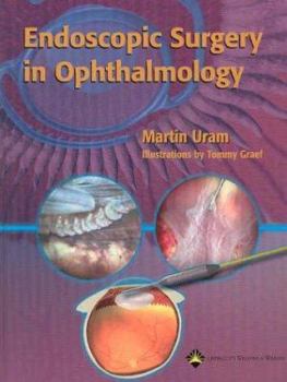 Hardcover Endoscopic Surgery in Ophthalmology Book