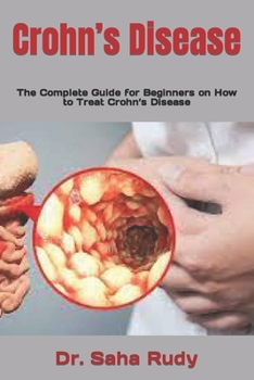 Paperback Crohn's Disease: The Complete Guide for Beginners on How to Treat Crohn's Disease Book