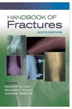 Paperback Handbook of Fractures Book