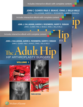 The Adult Hip 3-Volume Package: Arthroplasty and Its Alternatives and Hip Preservation Surgery