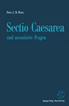 Paperback Sectio Caesarea Und Assoziierte Fragen [German] Book