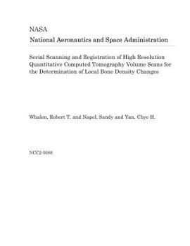 Paperback Serial Scanning and Registration of High Resolution Quantitative Computed Tomography Volume Scans for the Determination of Local Bone Density Changes Book