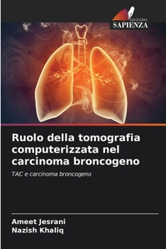 Paperback Ruolo della tomografia computerizzata nel carcinoma broncogeno [Italian] Book