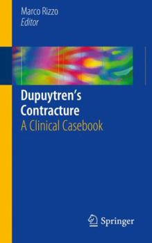 Paperback Dupuytren's Contracture: A Clinical Casebook Book